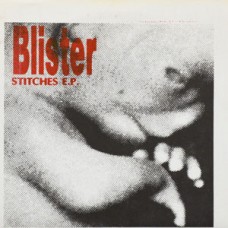 Blister - Stitches
