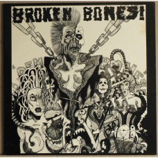 Broken Bones - Dem Bones