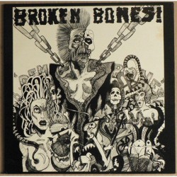 Broken Bones - Dem Bones